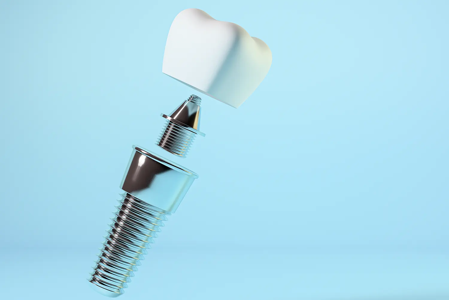 Can I Get Dental Implants if I Have Gum Disease?