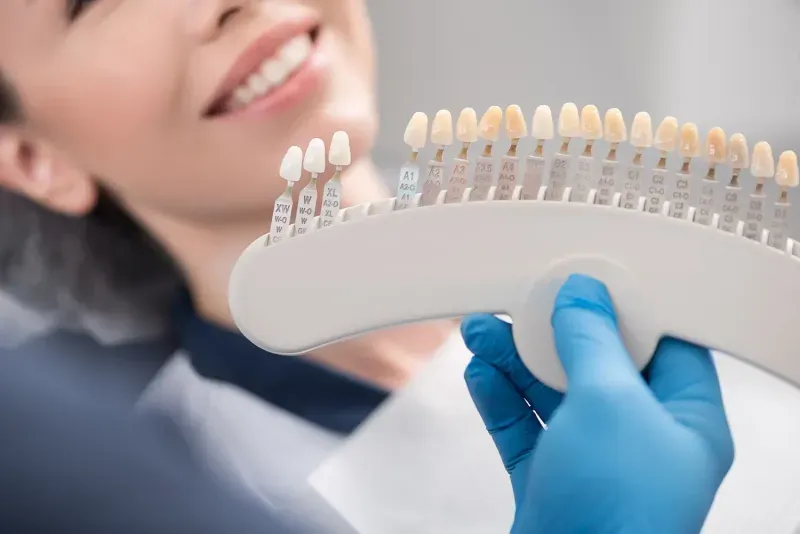 The Difference Between Bonding and Veneers