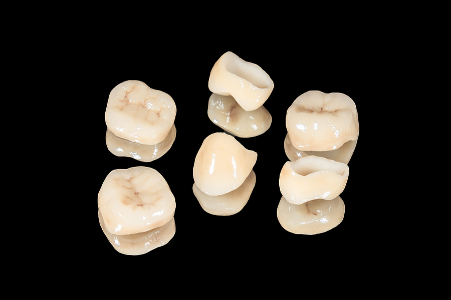 Restore Your Smile with Durable Dental Crowns in Portland, OR